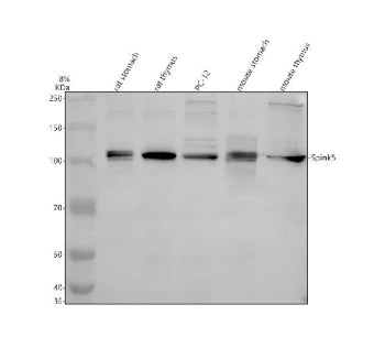 Western blot analysis of Spink5 using anti-Spink5 antibody. Electrophoresis was performed on a 8% SD