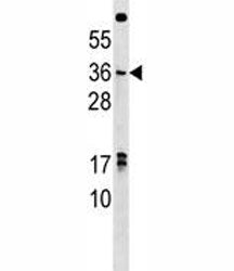 NKX3.1 antibody western blot analysis in U251 lysate. Predicted molecular weight ~28 kDa, observed a