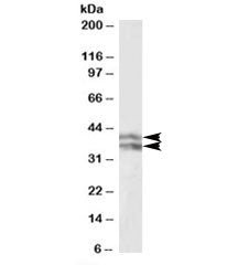 Western blot testing of human liver lysate with HP antibody at 0.1ug/ml. Predicted molecular weight: