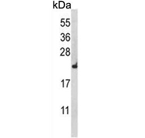 Western blot testing of human HEK293 cell lysate with RPL18A antibody. Predicted molecular weight ~2