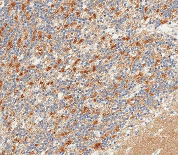 NCAM / CD56 Antibody