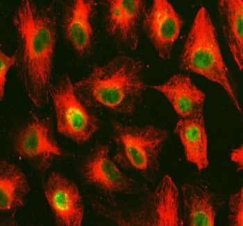 Immunofluorescent staining of OMA1 using anti-OMA1 antibody (green) and anti-Tubulin Alpha antibody