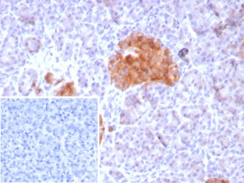 GAD65 Antibody / GAD2