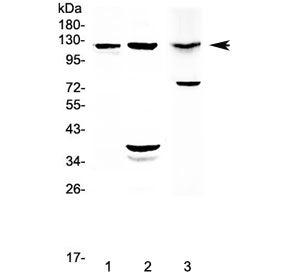 Western blot testing of 1) rat lung, 2) rat pancreas and 3) mouse pancreas with MUC1 antibody at 0.5