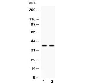 Western blot testing of human 1) HeLa and 2) A549 cell lysate with Annexin VIII antibody at 0.5ug/ml
