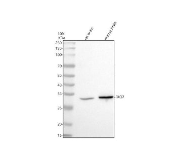 Western blot analysis of DIO2 using anti-DIO2 antibody. Electrophoresis was performed on a 10% SDS-P
