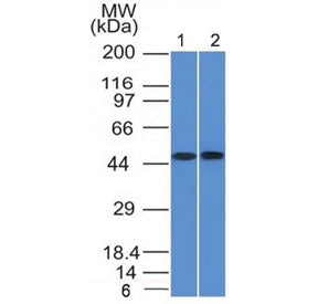 Western blot of human 1) THP1 and 2) Raji cell lysate using FLI1 antibody (clone FLI1/1312). Predict