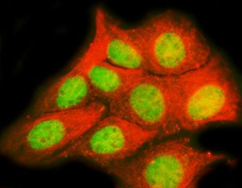 Immunofluorescent staining of FFPE human MCF7 cells with TRPS1 antibody (green) and Alpha Tubulin mA