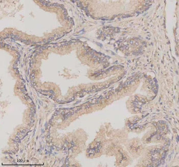 Immunohistochemical staining of TMEM175 using anti-TMEM175 antibody. TMEM175 was detected in a paraf