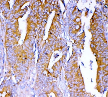 DYNLT1 Antibody