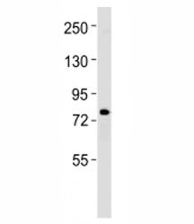 ERCC2 Antibody
