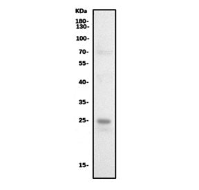 Western blot testing of human A549 cell lysate with Cathepsin L antibody. Expected molecular weight: