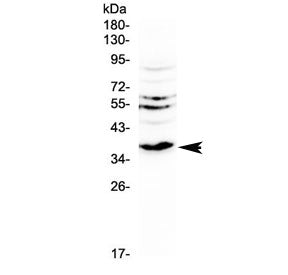 Western blot testing of rat kidney tissue with Il12 p40 antibody at 0.5ug/ml. Predicted molecular we