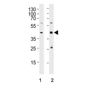 Western blot testing of human 1) Daudi and 2) HL60 cell lysate with MCUB antibody. Predicted molecul