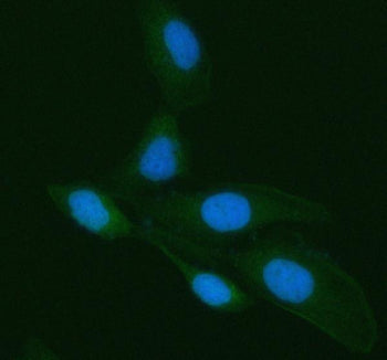 Immunofluorescent staining of Galectin-3/LGALS3 using anti-LGALS3 antibody (green). Galectin-3/LGALS