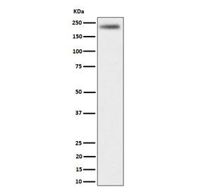 Western blot testing of human HeLa cell lysate with DENN antibody. Predicted molecular weight ~176 k