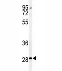 Caspase-3 Antibody