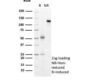SDS-PAGE analysis of purified, BSA-free Arginase 1 antibody (clone ARG1/8869R) as confirmation of in