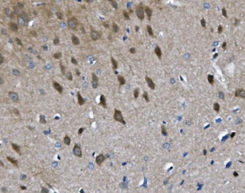 Chat Antibody / Choline Acetyltransferase