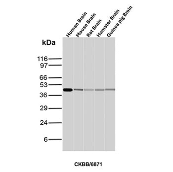Western blot analysis of Human Brain, Mouse Brain, Rat Brain, Hamster Brain and Guinea pig Brain tis