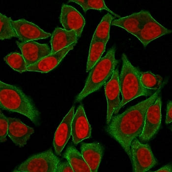Immunofluorescent staining of fixed and permeabilized human HeLa cells with recombinant Spectrin bet