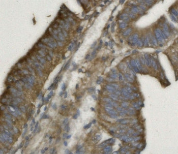 Prohibitin 2 Antibody / PHB2