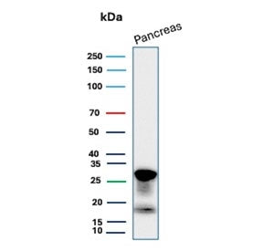 Western blot testing of human pancreas tissue lysate with Elastase 3A antibody (clone CELA3A/12552).
