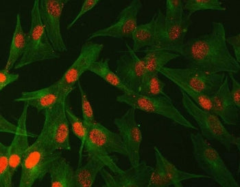 Immunofluorescent staining of FFPE human U-87 MG cells with Abelson interactor 2 antibody (red) and