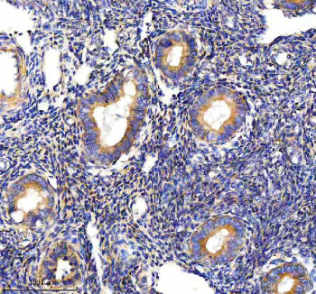 Immunohistochemical staining of PALS1 using anti-PALS1 antibody. PALS1 was detected in a paraffin-em