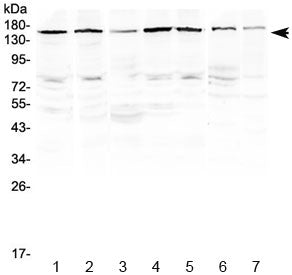 Western blot testing of human 1) HeLa, 2) MCF7, 3) A549, 4) HepG2, 5) COLO320, 6) rat heart and 7) m