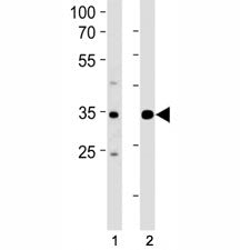 ATF4 antibody western blot analysis in (1) Jurkat and (2) MCF-7 lysate. Predicted molecular weight ~