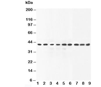 Western blot testing of ERK2 antibody and Lane 1: human placenta; 2: rat liver; 3: rat brain; 4: rat