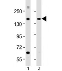 MTUS1 Antibody / Microtubule-associated tumor suppressor 1