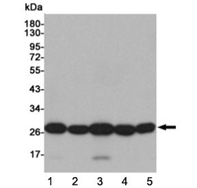 Superoxide Dismutase 2 Antibody / SOD2