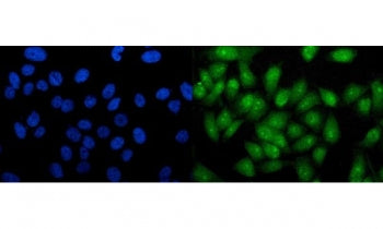 Immunofluorescent staining of FFPE human PC-3 cells with RTCA antibody (green) and DAPI nuclear stai