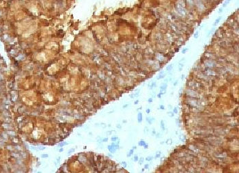 IHC testing of FFPE human colon tissue with recombinant AURKB antibody (clone ARRK2-2R). HIER: boil