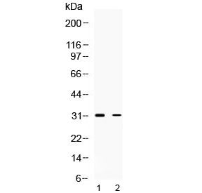 Western blot testing of 1) rat brain and 2) human HeLa lysate with TSG6 antibody at 0.5ug/ml. Predic