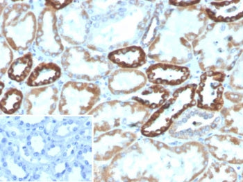 IHC staining of FFPE human kidney tissue with PLA2R1 antibody (clone PLA2R1/4891). Inset: PBS used i