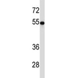TUBB2A antibody western blot analysis with HEK293 lysate. Predicted molecular weight ~50 kDa.