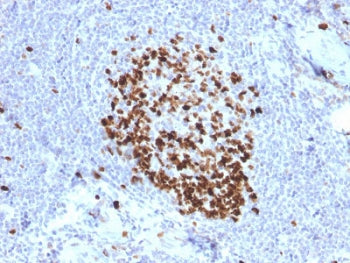 Ki67 Antibody
