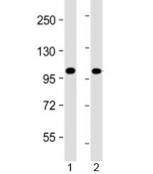 Western blot testing of human 1) Jurkat and 2) K562 cell lysate with PRDM16 antibody at 1:4000. Pred