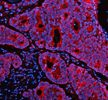 Immunofluorescent staining of PEX1 using anti-PEX1 antibody (red). PEX1 was detected in a paraffin-e