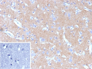 IHC staining of FFPE human brain tissue with HK1 antibody (clone HK1/9507). Inset: PBS used in place