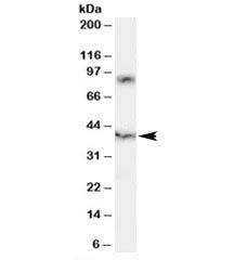 Western blot testing of human spleen lysate with HCST antibody at 0.2ug/ml. HCST is a 93 amino acid