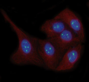 Immunofluorescent staining of LYAR using anti-LYAR antibody (green) and anti-Beta Tubulin antibody (