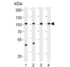 Western blot testing of 1) human SW620, 2) human PC-3, 3) mouse kidney and 4) rat kidney lysate with