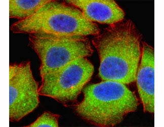 Fluorescent confocal image of U251 cell stained with RELA antibody at 1:25. RELA immunoreactivity is