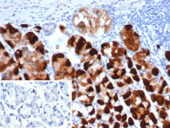 CKB Antibody / Creatine kinase B / Creatine Phosphokinase-BB