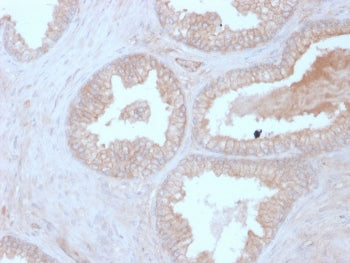 Calcineurin B Antibody / PPP3R1