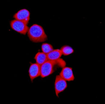 STUB1 Antibody
